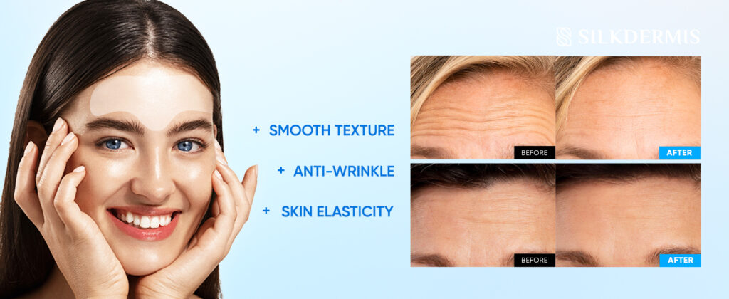 Forehead Wrinkle Patches